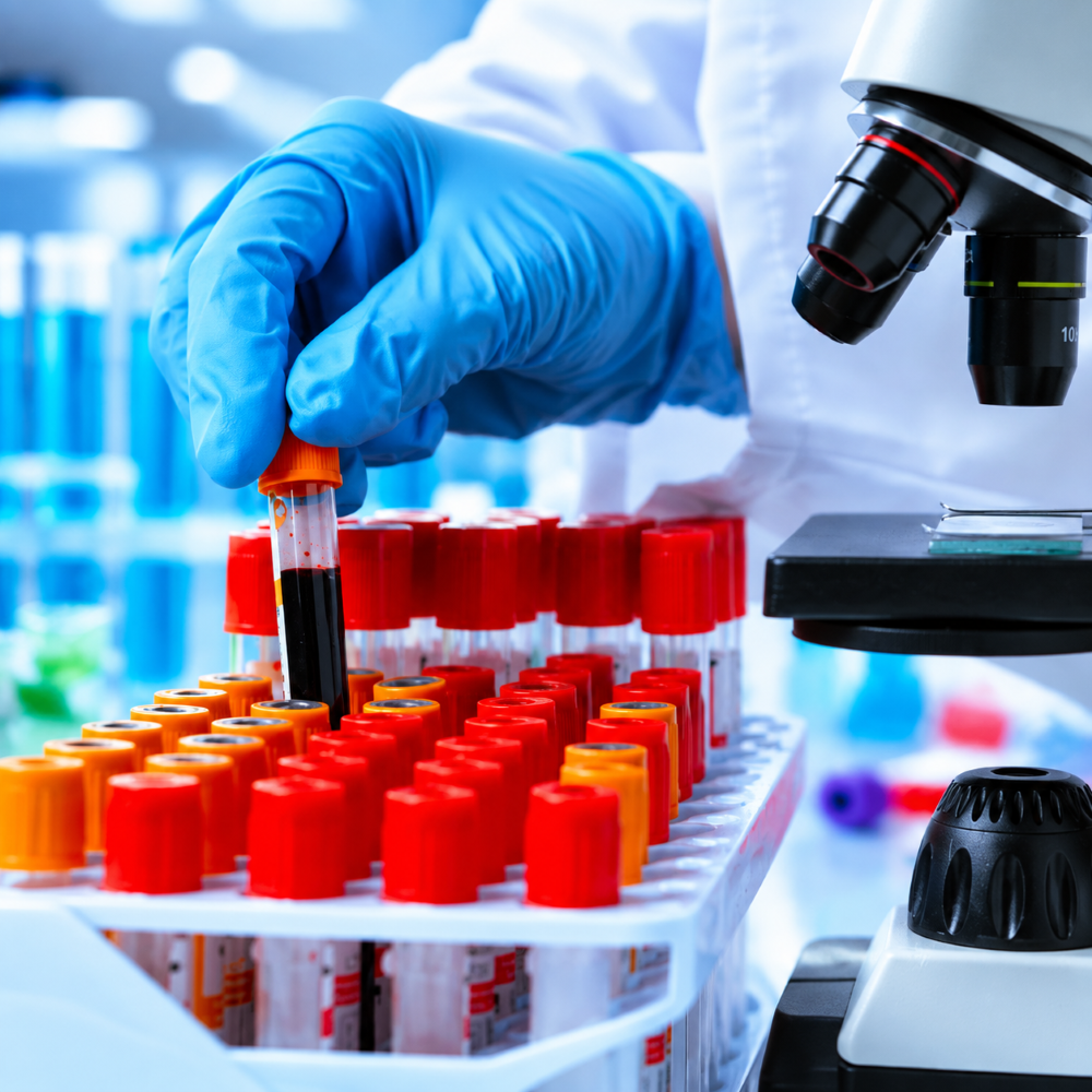 Essential Lab Tests Made Easy: Why Your Health Belongs in One Safe Place